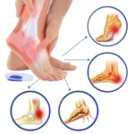 Podpiętki żelowe rozmiar L N84L (2 szt.) - obrazek 3