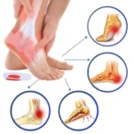 Podpiętki żelowe rozmiar S N84S (2 szt.) - obrazek 4