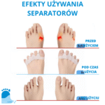 Oddychający separator z klinami N93 (2 szt.) - obrazek 2