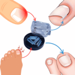 Paski ochronne na wrastające paznokcie N92 (10szt.) - obrazek 2